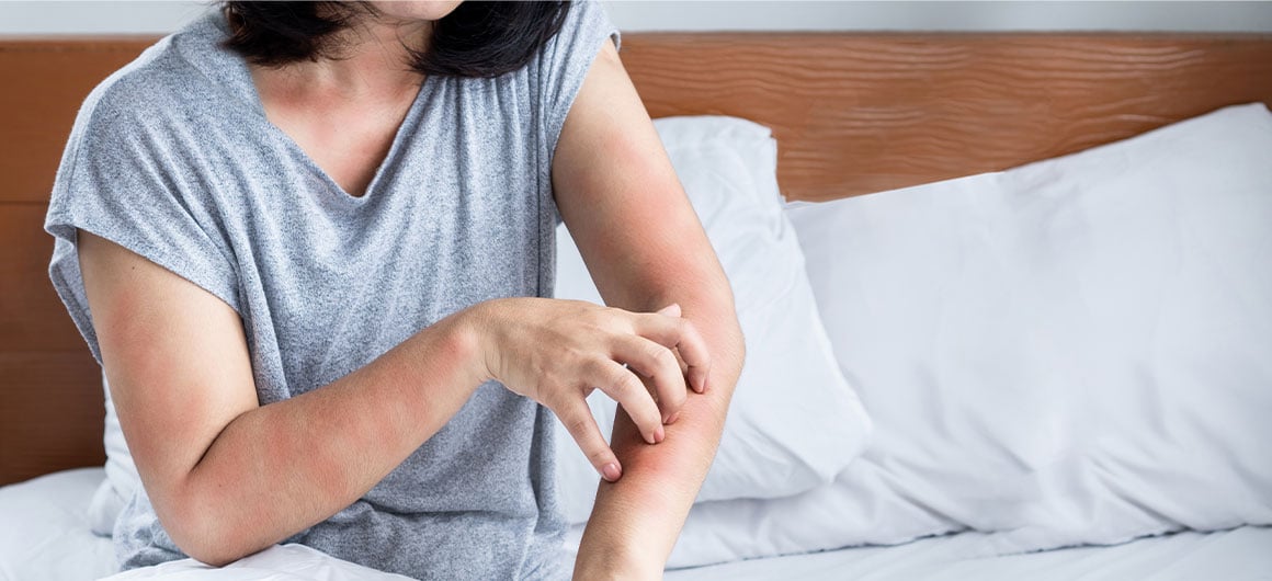 woman in bed scratching arm