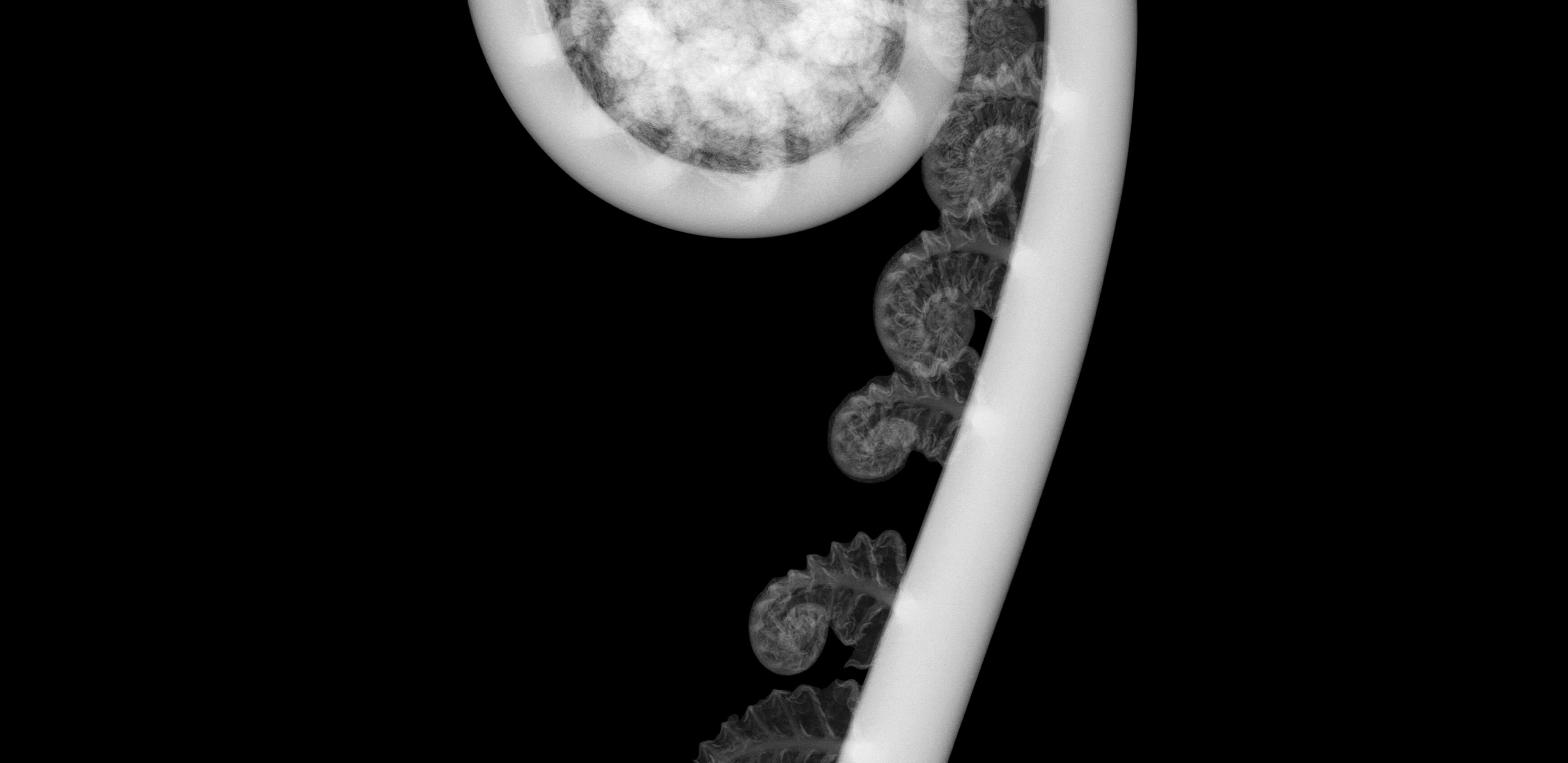 A close up of a tentacle, in black and white