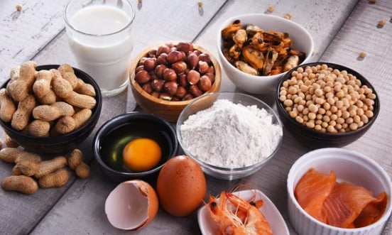 Assorted Food Allergens Various common food allergens including peanuts, milk, hazelnuts, mussels, soybeans, egg, flour, shrimp, and salmon.
