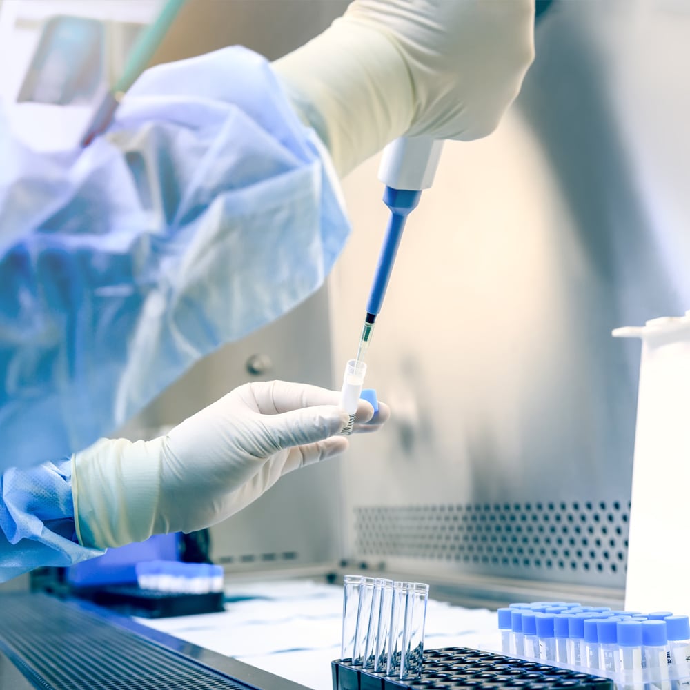 Polymerase Chain Reaction (PCR) Tests