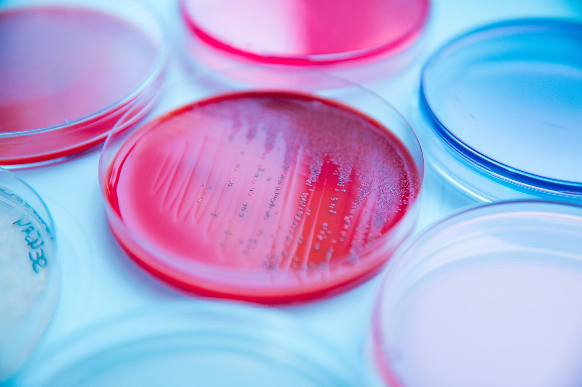 Food | Mikrobiologie