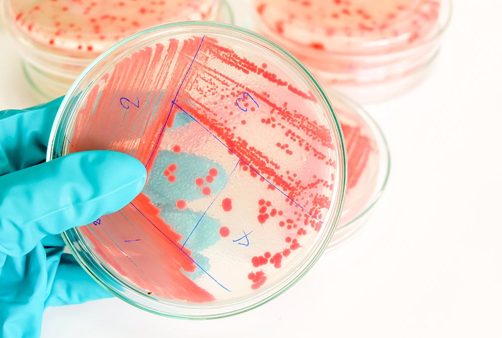 A gloved hand holds a petri dish containing bacterial colonies labeled for research analysis.