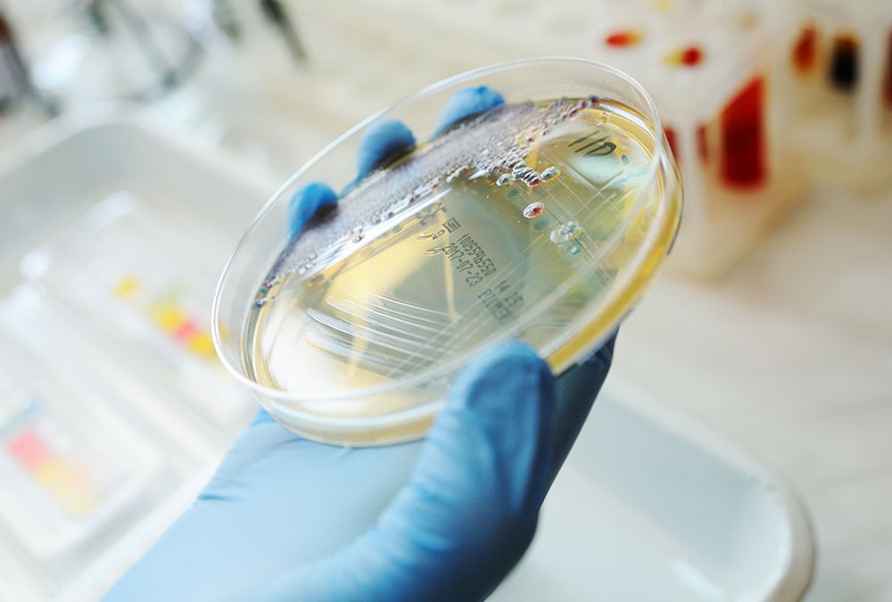 A gloved hand holds a petri dish filled with a yellow liquid with small dark particles floating in it.