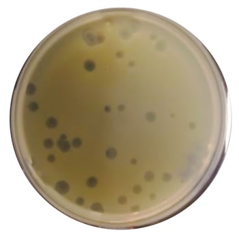 Image of an optimal number of plaques for counting and evaluation.
