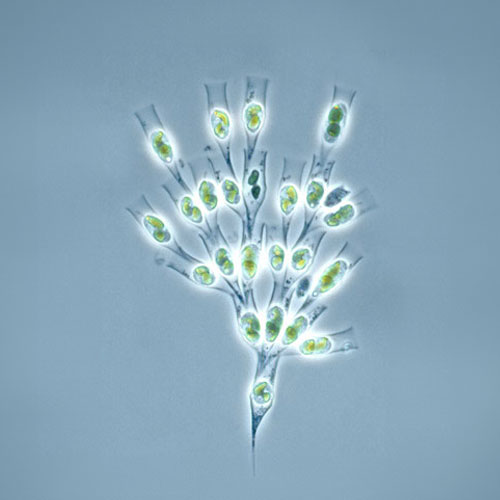 Dinobryon – commonly associated with filter blockages