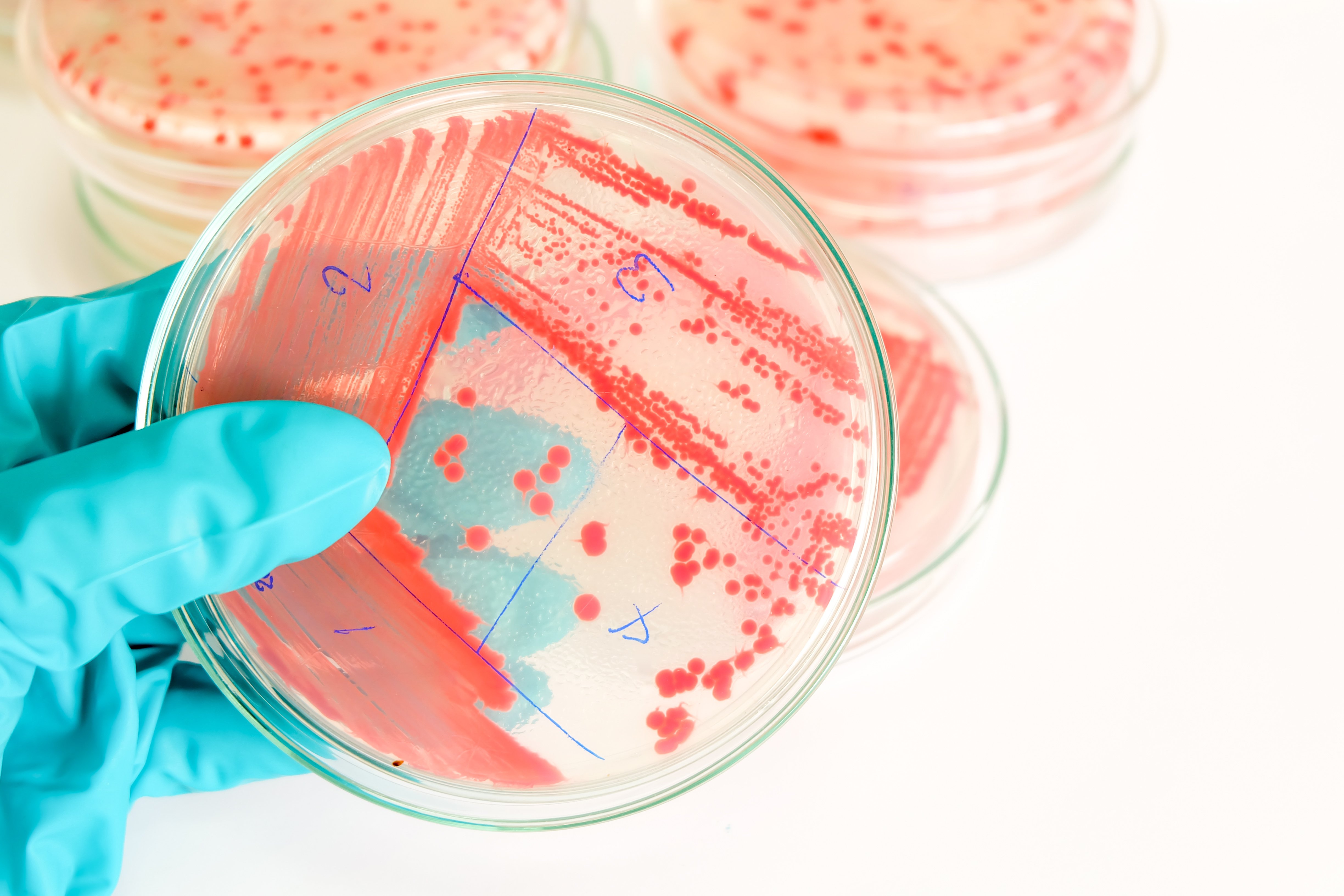 Široká škála mikrobiologických testů