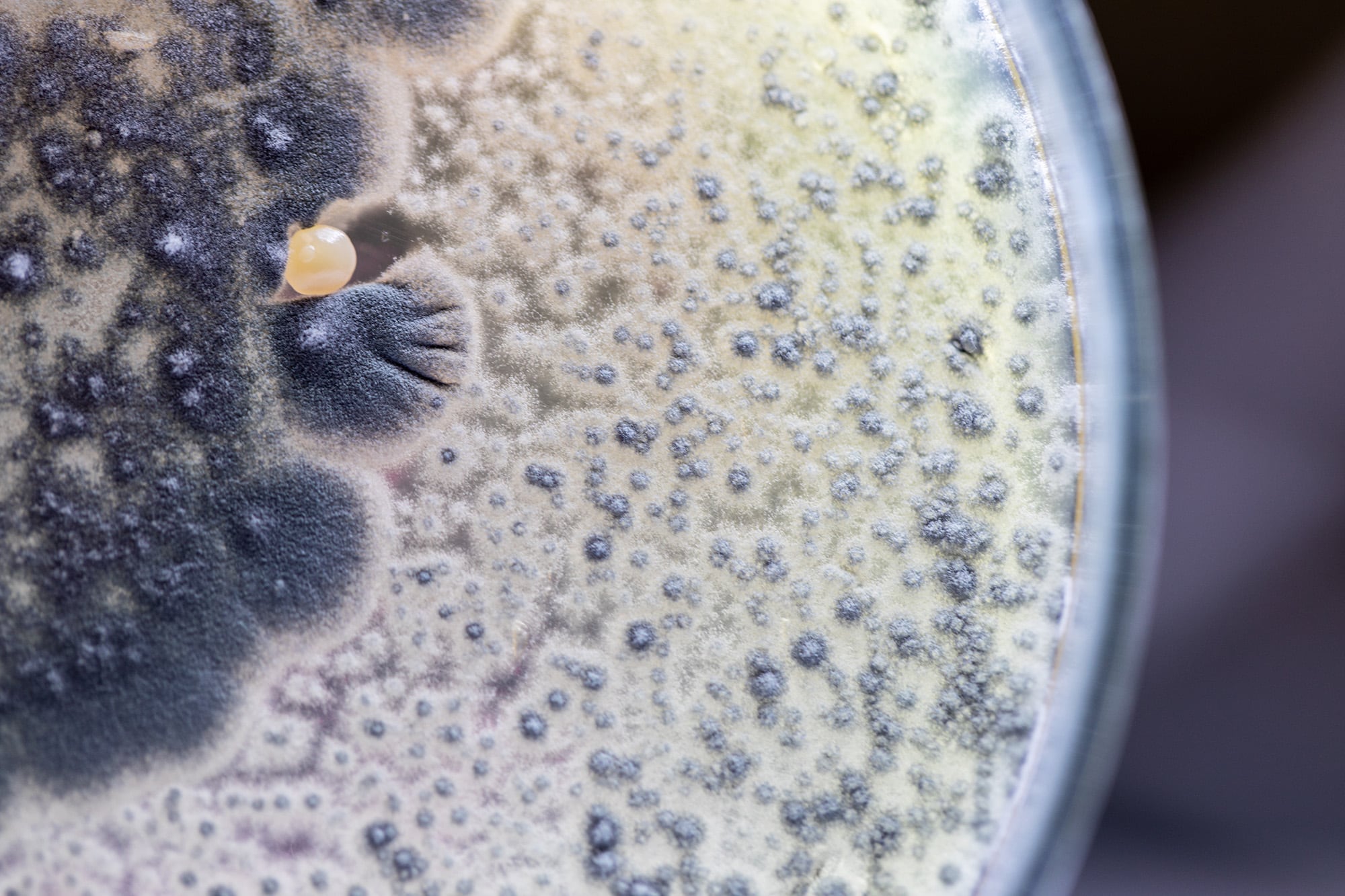 microbiology macro