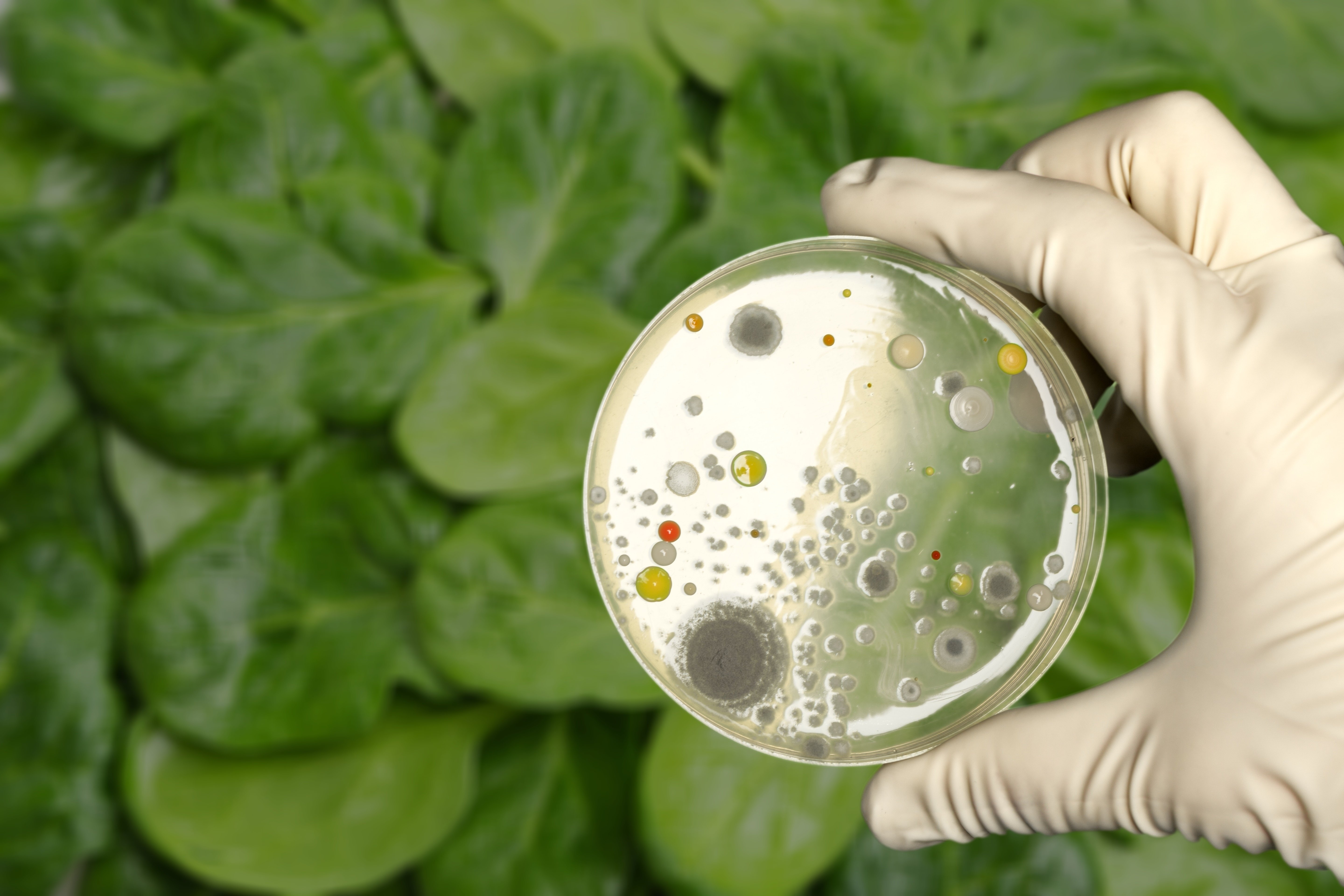 Analyses microbiologiques