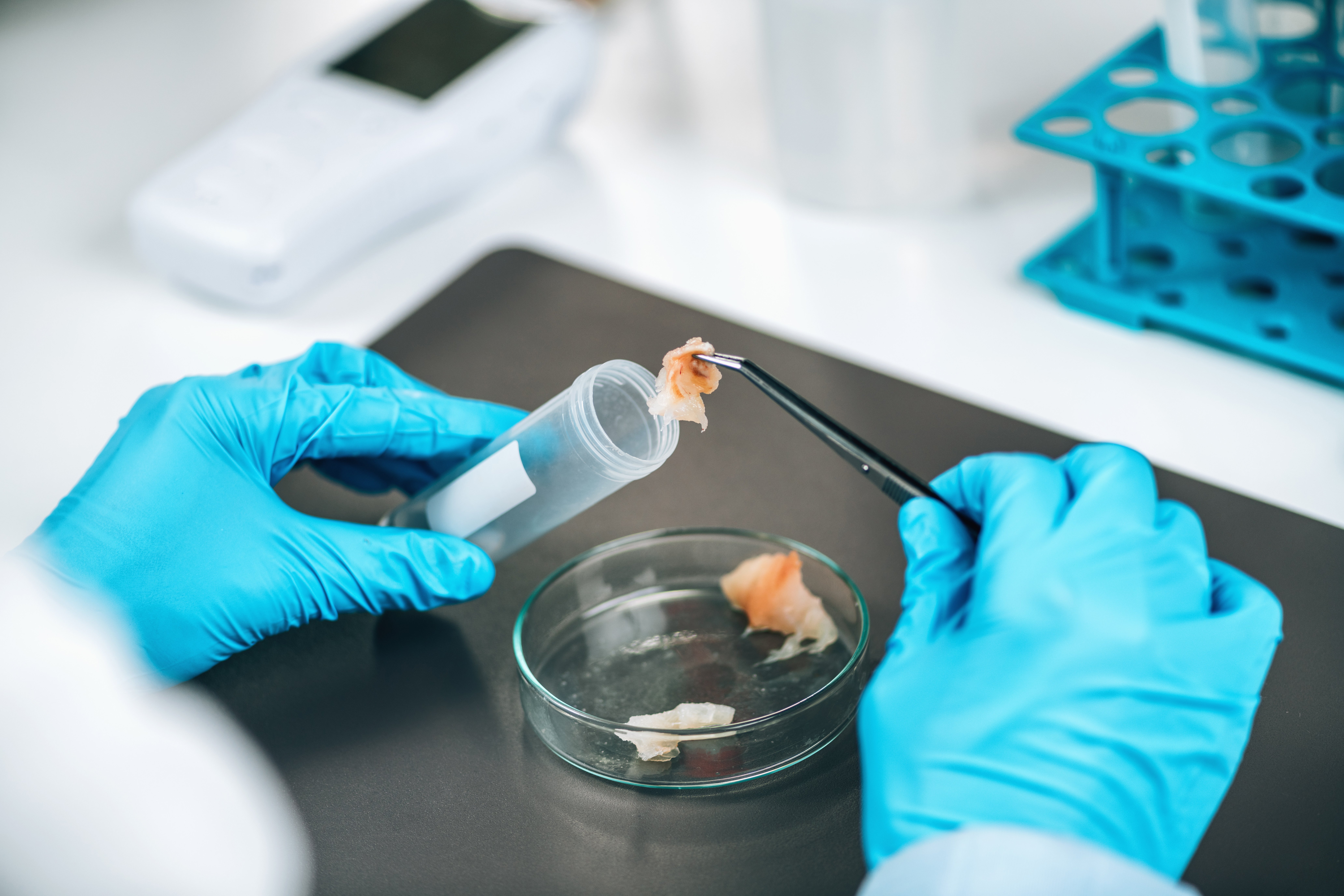 Scientist wearing blue gloves handling a fish sample with tweezers and a tube over a petri dish in a laboratory.