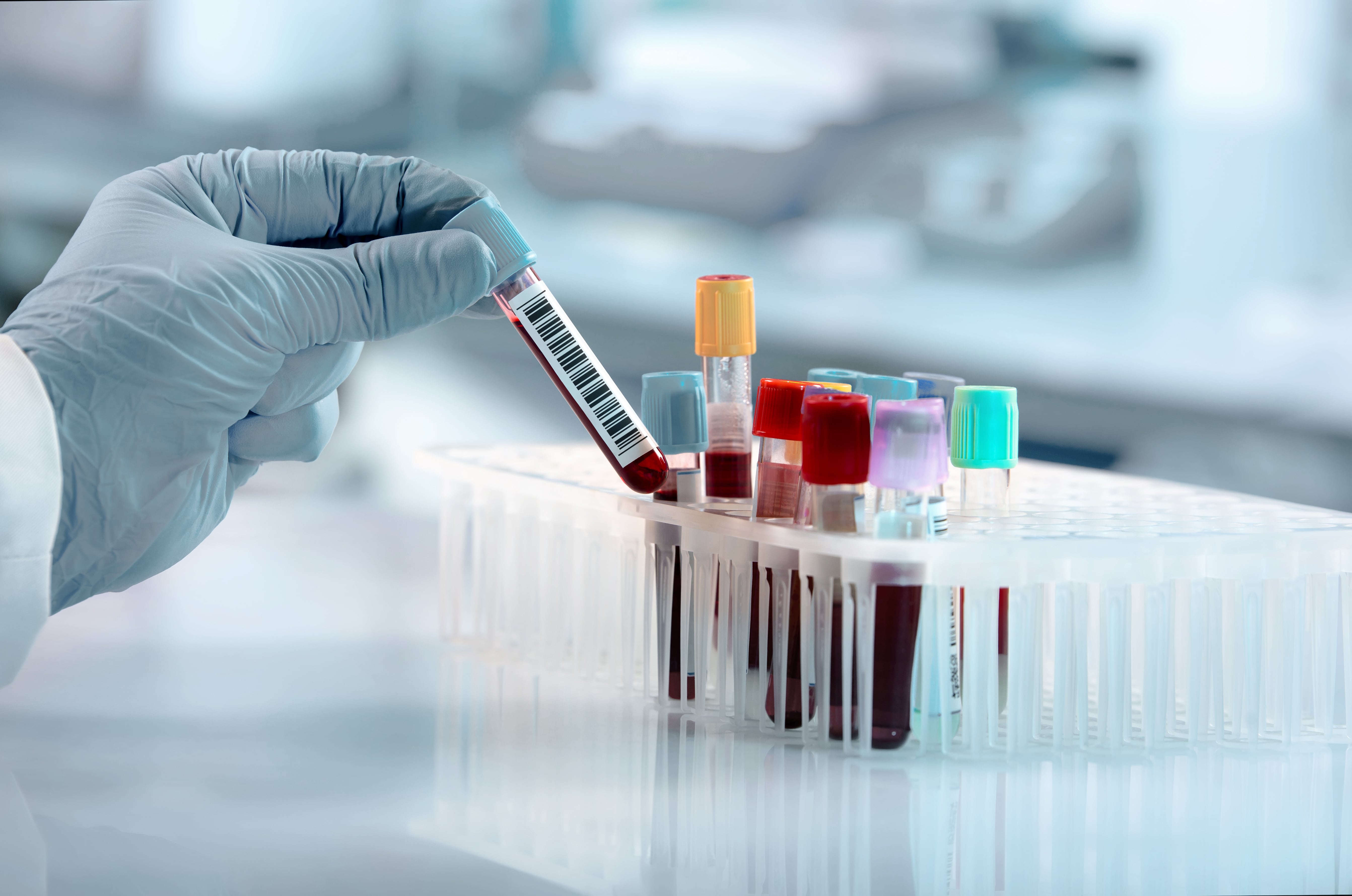 Gloved hand holding a blood sample tube above a rack containing multiple tubes with colored caps in a laboratory setting.