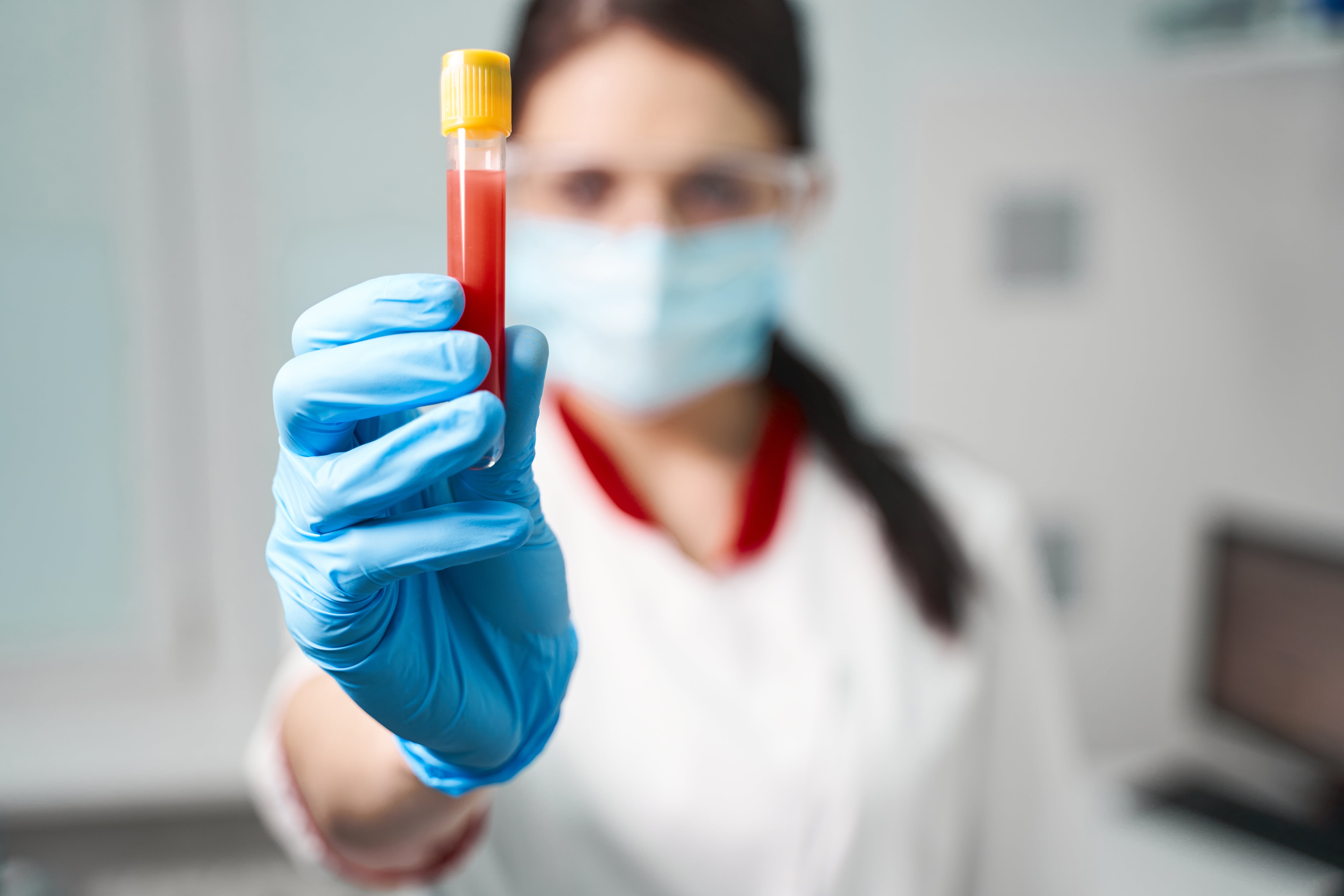 Gloved hand holding a blood sample tube in a laboratory setting.