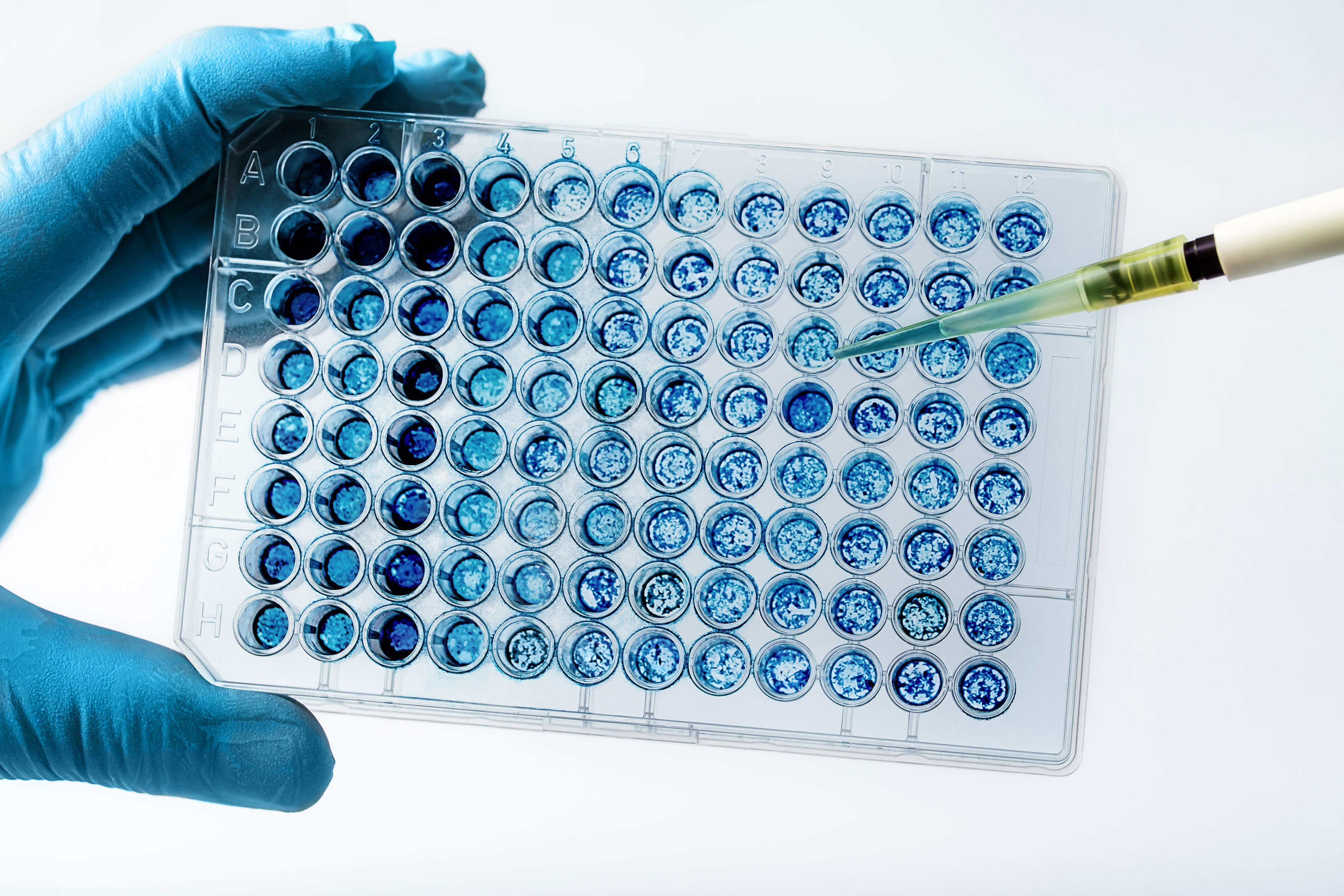Scientist pipetting samples into a microplate in a laboratory setting