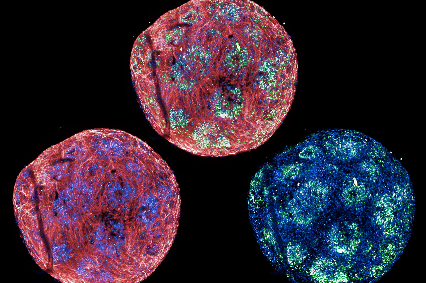 Staining of fate markers in human brain organoids grown in 384-well format 