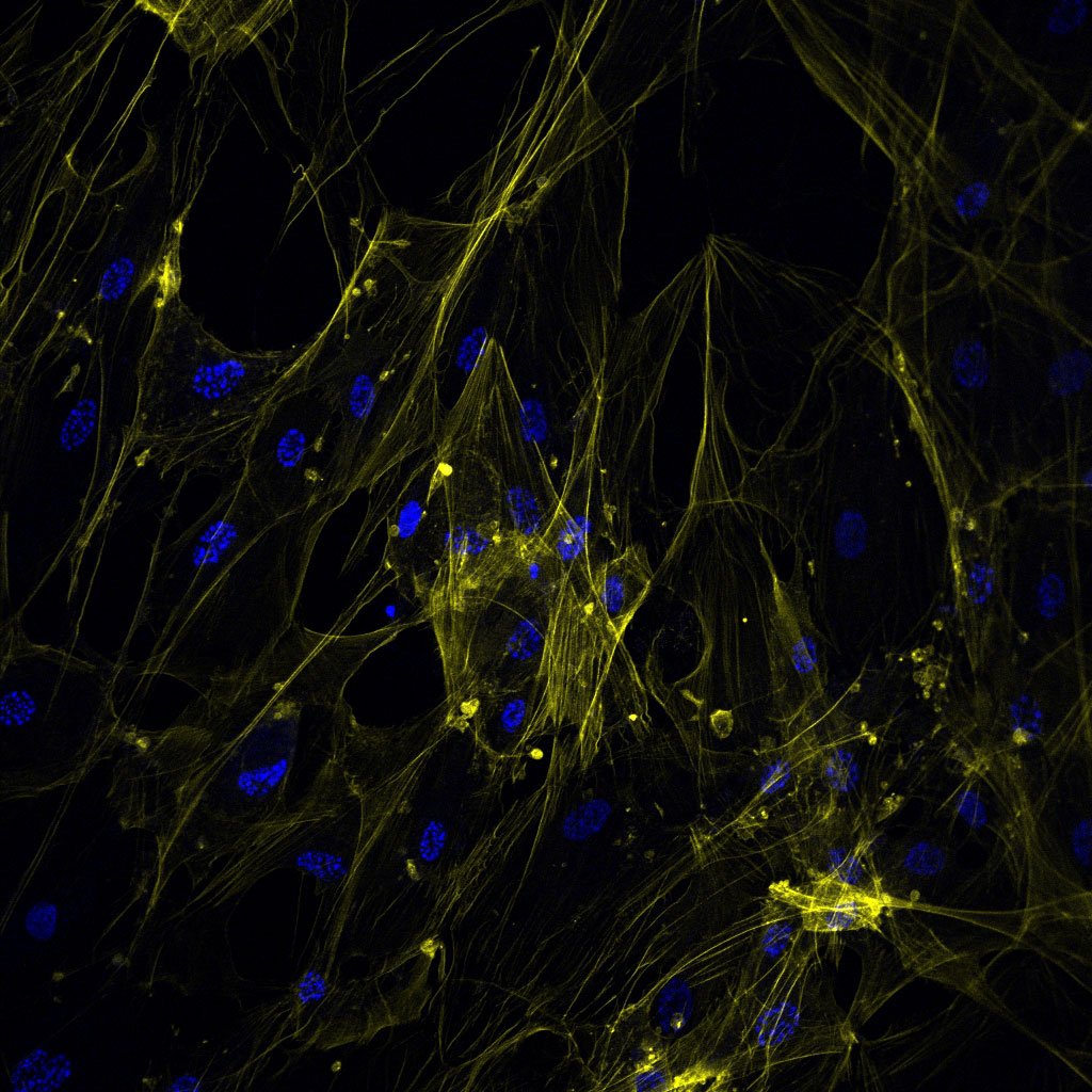 High content analysis of tissue culture.
