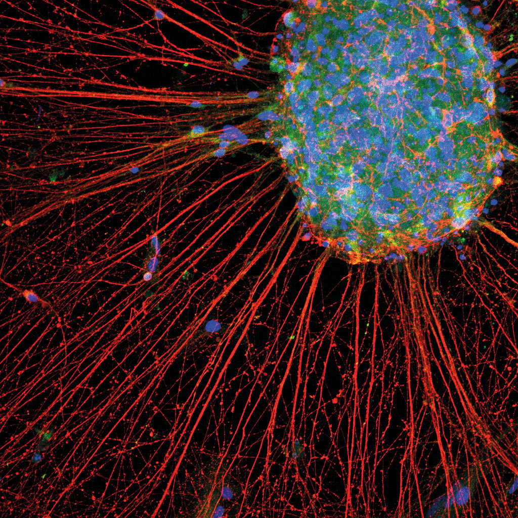 Immunofluorescent image of human iPSC-derived nociceptor neurons stained for TrkA and MAP2