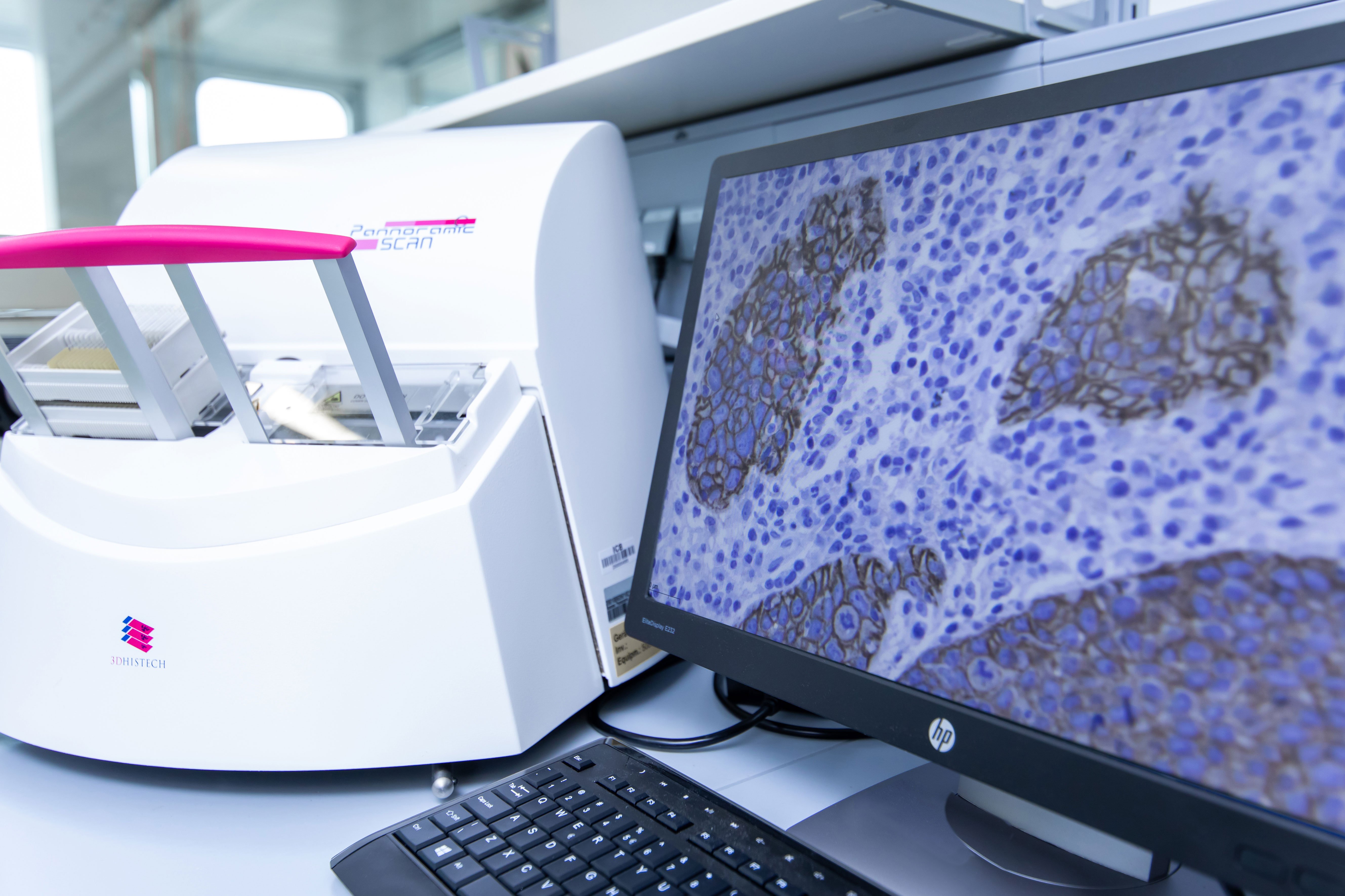 IHC