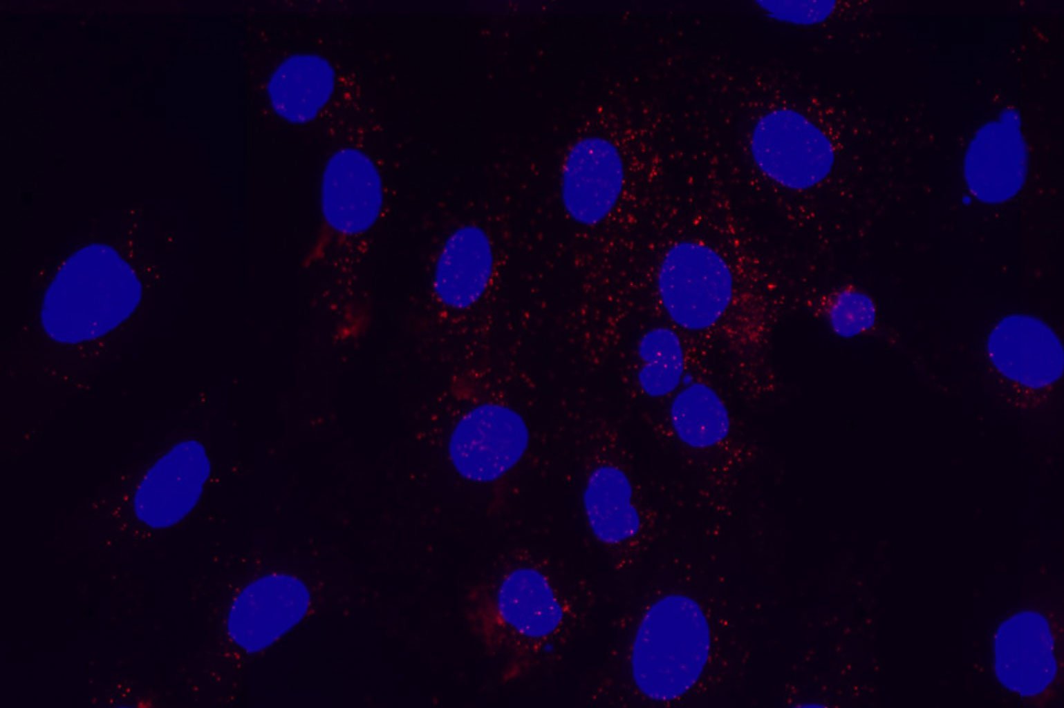EGFR-Her2 complex formation in EGF-treated cancer cells