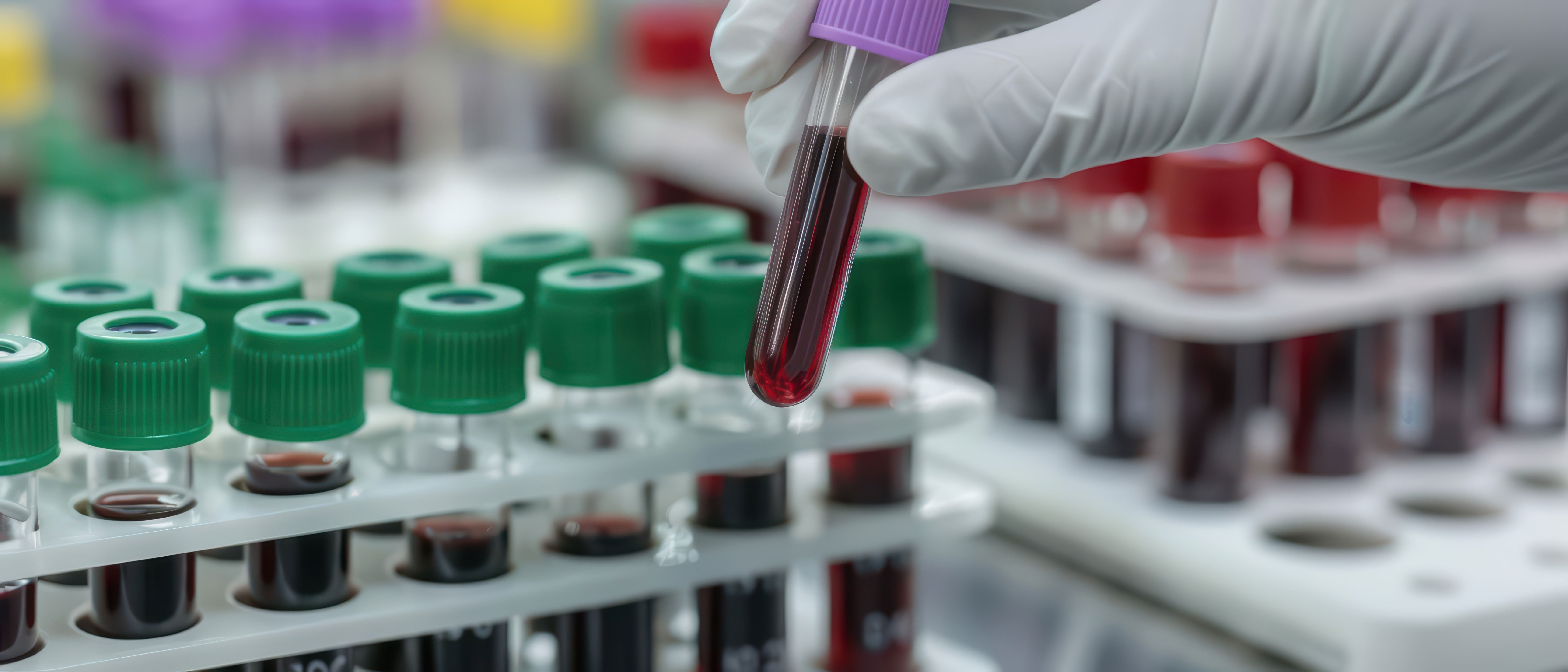 Laboratory medicine analyzes bodily fluids and tissues to aid in the detection and monitoring of diseases
