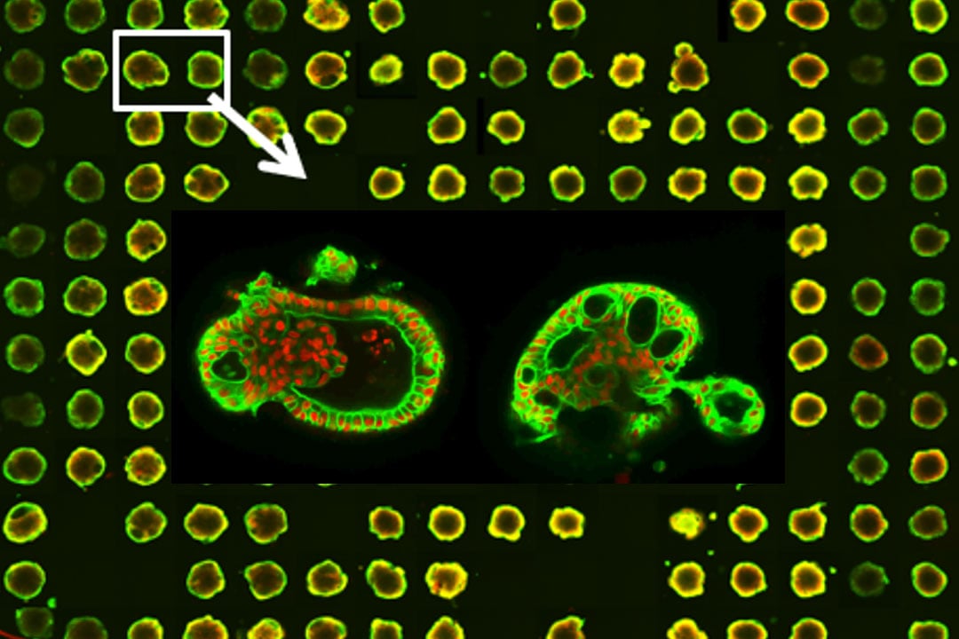 Assessing kidney organoid morphology using high-throughput high-content imaging