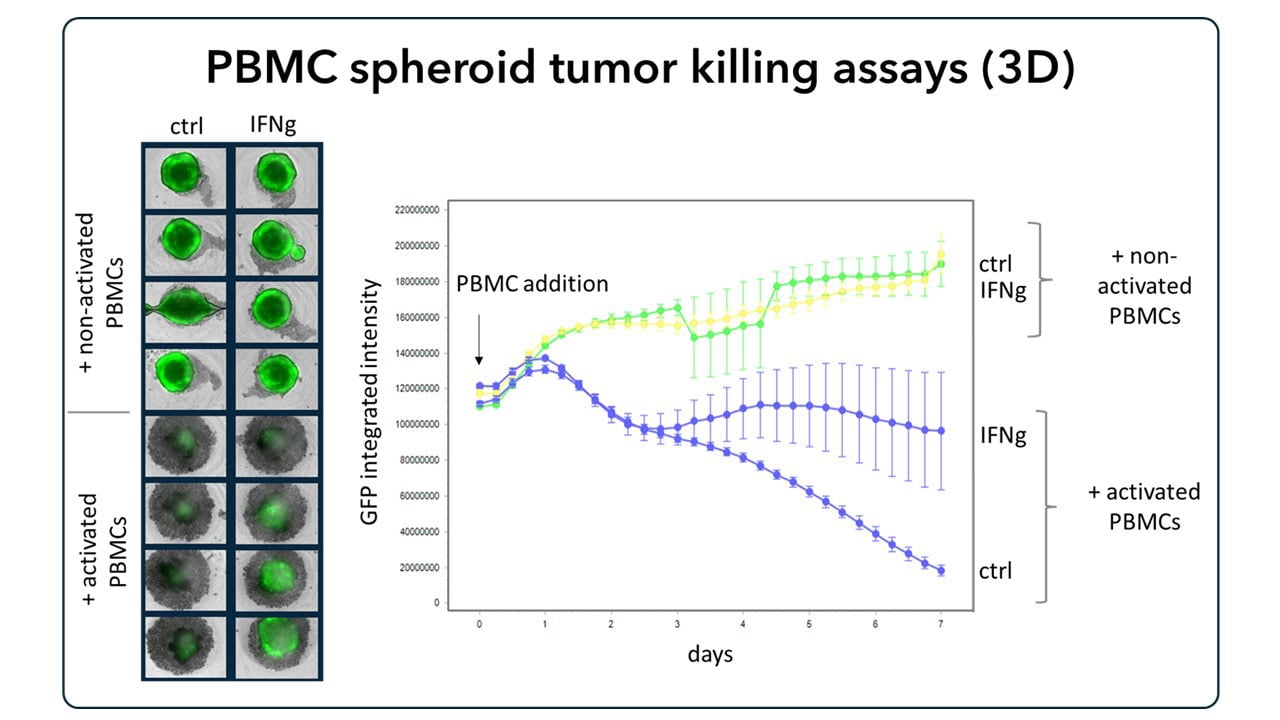 IFNgamma-pretreated cancer cells form spheroids on low-attachment plates; PBMCs added to assess spheroid viability via Incucyte