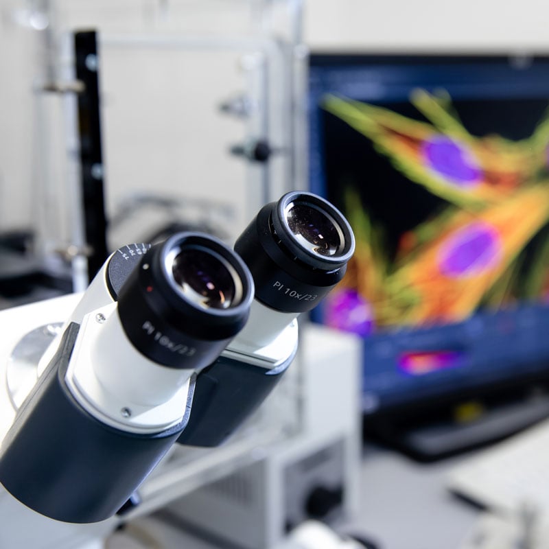 Nuvisan receives US$25 million grant to advance novel non-hormonal contraceptive drug discovery