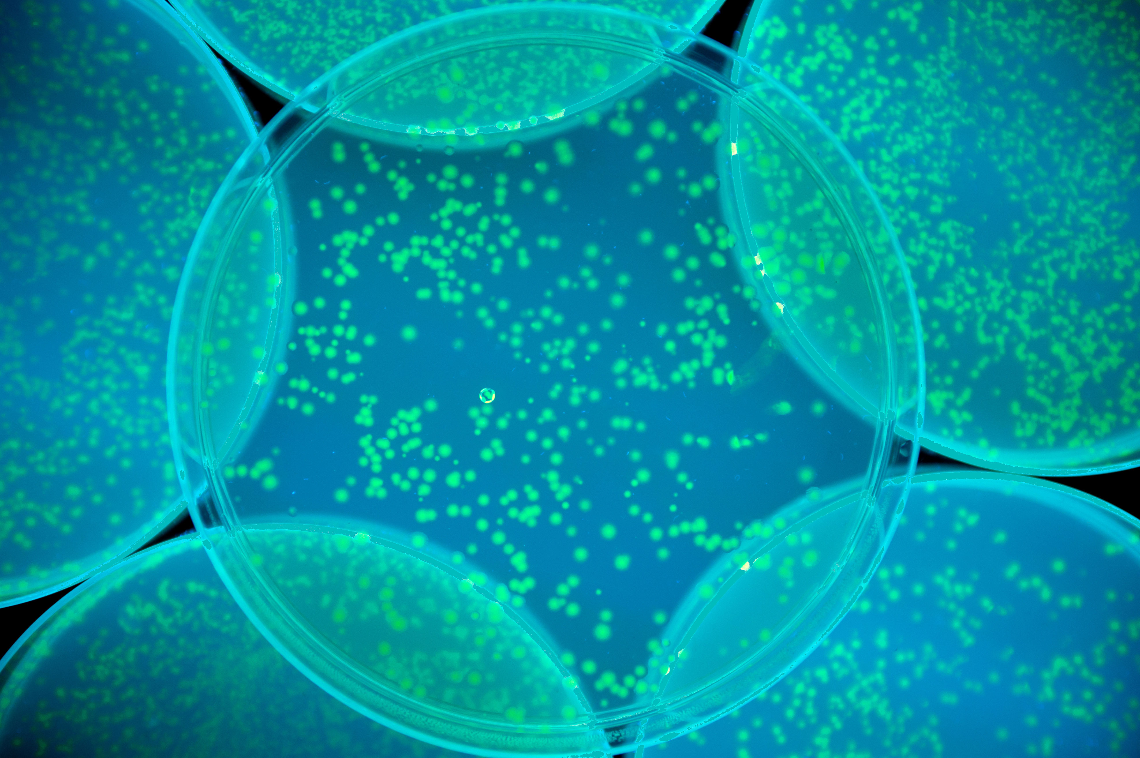 A hand in lab gloves holds a petri dish with bacterial colonies, with a microscope visible in the background.