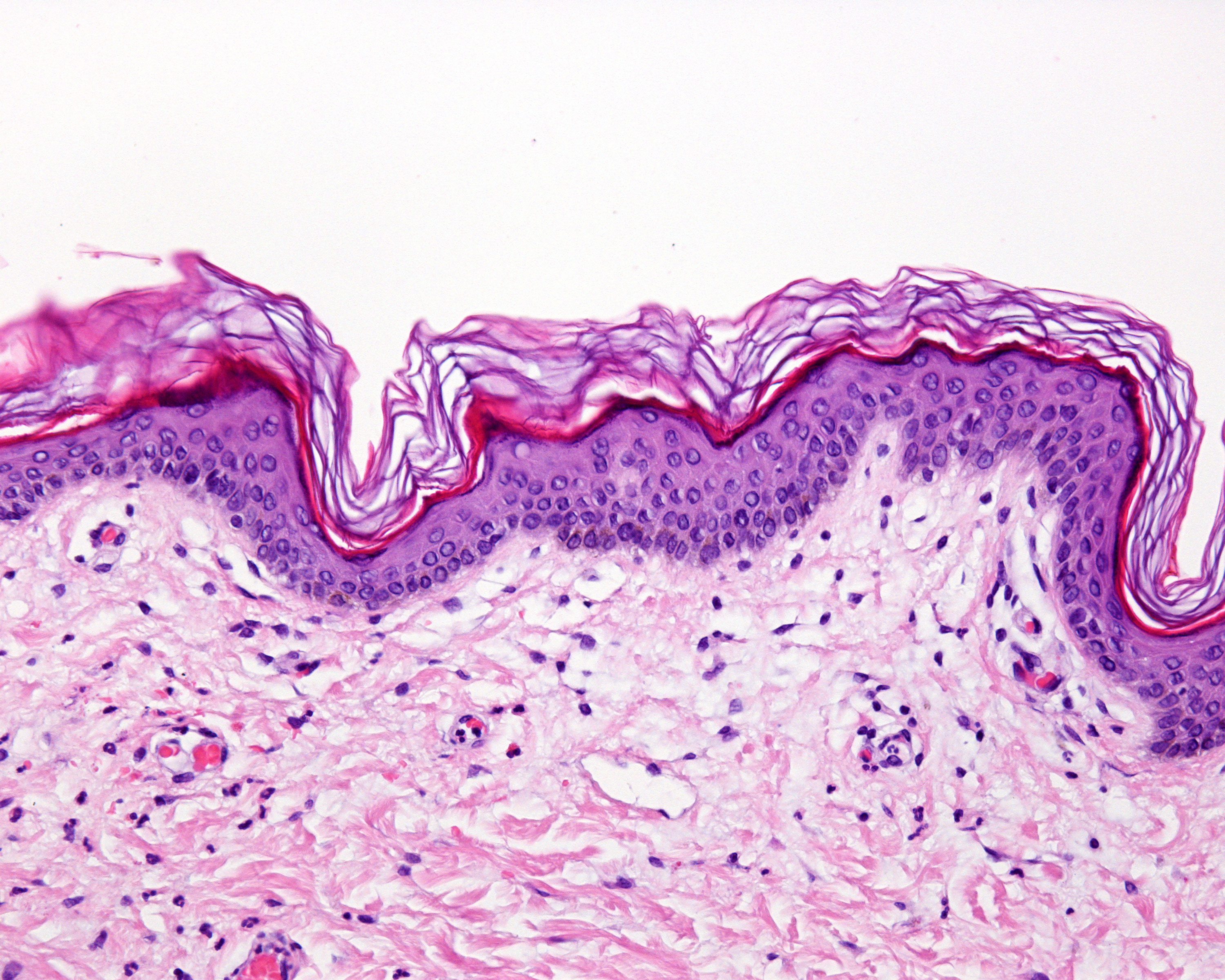 Microscopy image showcasing stained human skin tissue, highlighting cellular structures and histological features.