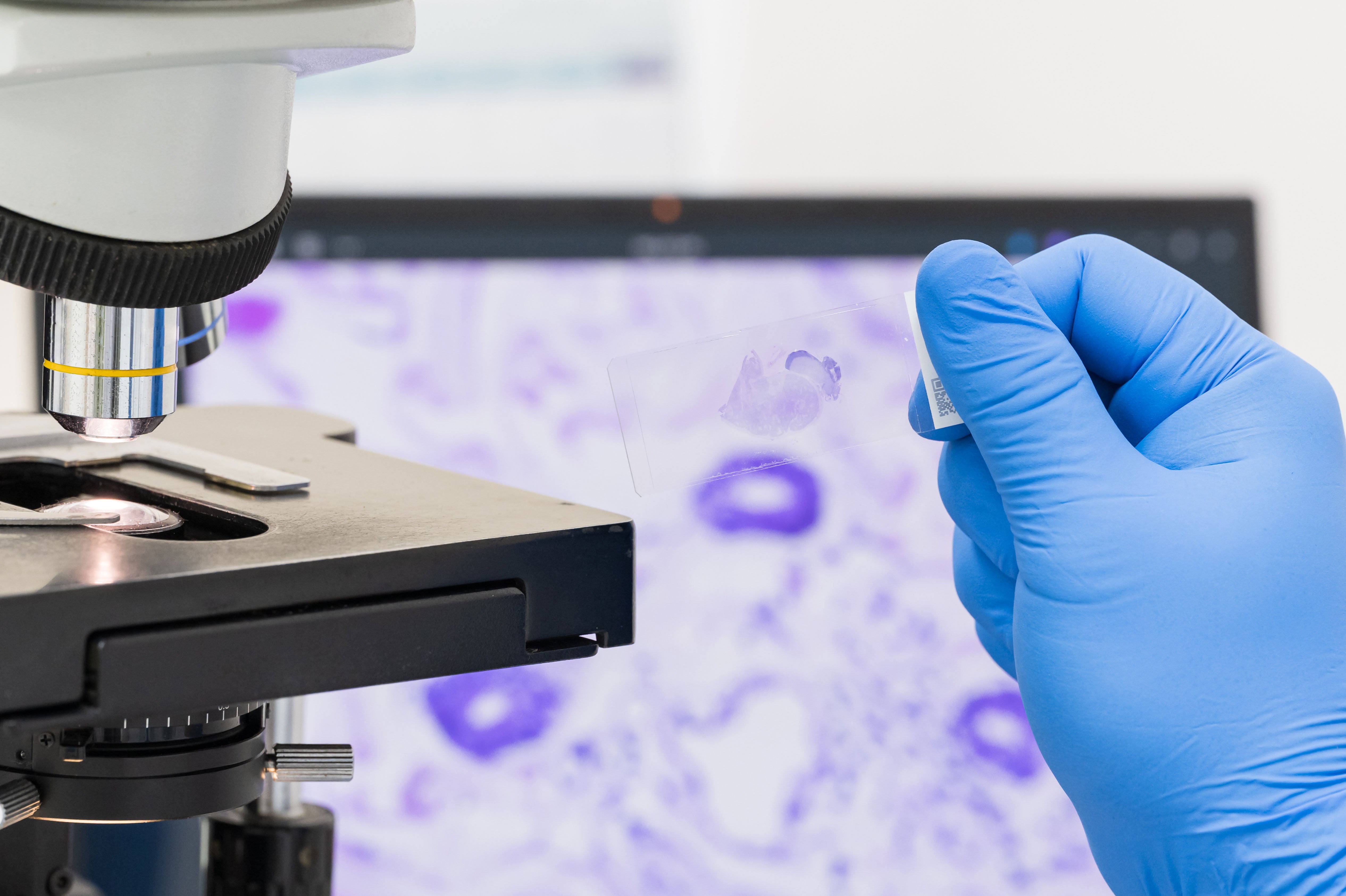 A scientist's hand holds a microscopy slide with a tissue specimen, with a microscope and computer screen in the background.
