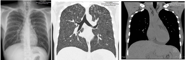 Three radiological images from the 2024 Case in Point Winner