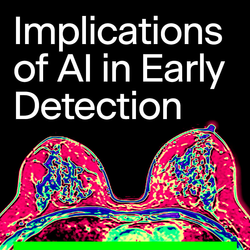 Implications of AI in Early Detection of Breast Cancer Through MRI