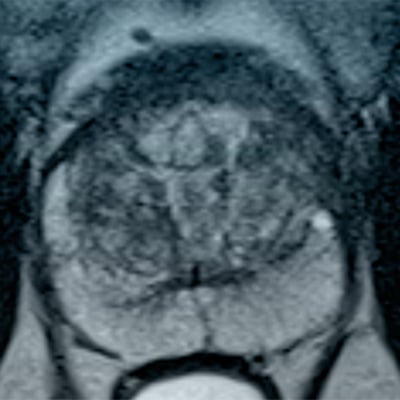 ACR Education Center Prostate MR Virtual Course — Case Review Virtual Course Image