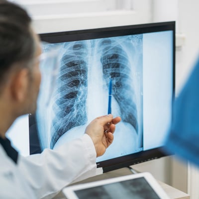 Male radiologist seen from behind uses a pen to point to an image of a lung CT on a computer monitor.