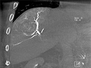 Radiation Safety Case Study
