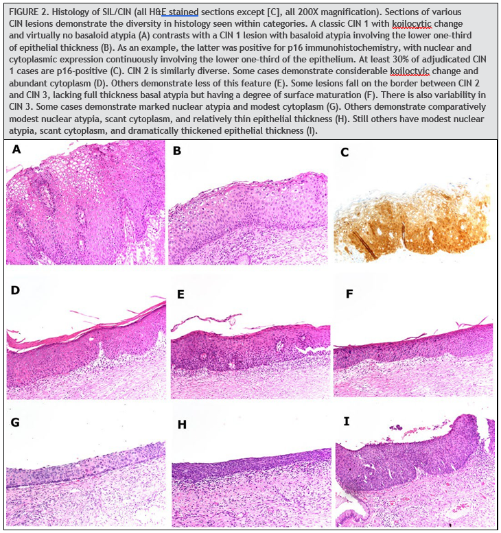 Nine panels showing sections of various CIN lesions 