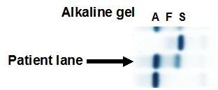 Does This Abnormal Hemoglobin Indicate Sickle Cell Trait?6-1