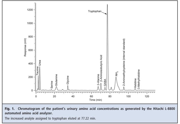 Fig 1. Chromatogram of the patient's urinary amino acid concentrations as genearted by Hitachi L-8800