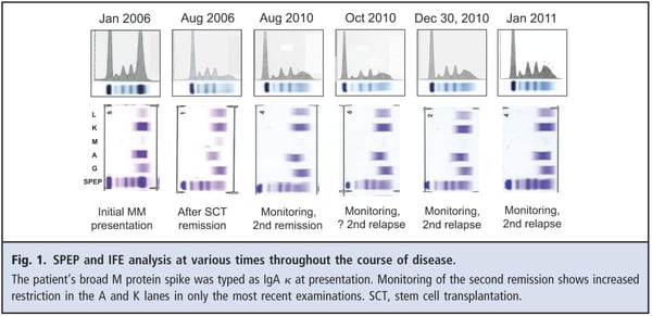 Fig 1. SPEP and IFE analysis at various times through the course of the disease