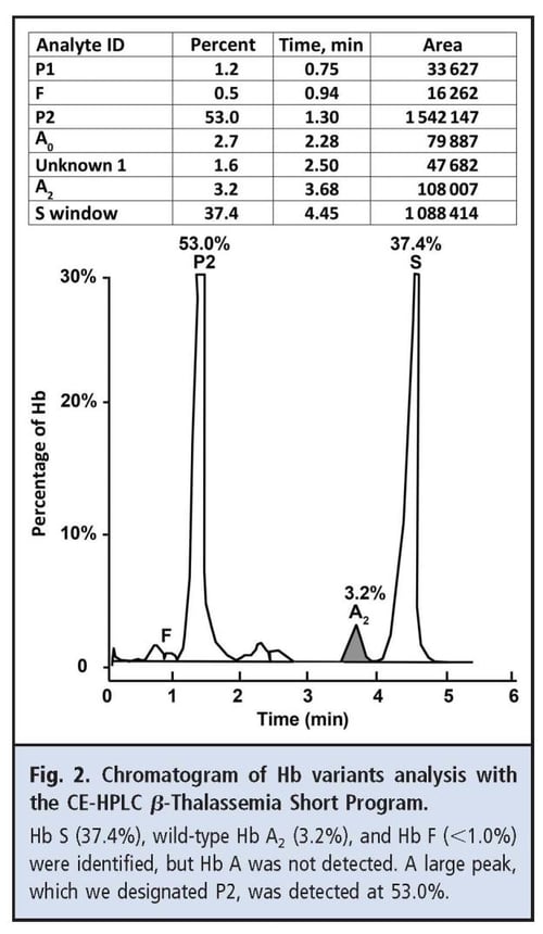 Fig 2 Chromatogram of Hb variants analysis with the CE-HPLC beta-thalassemia short program