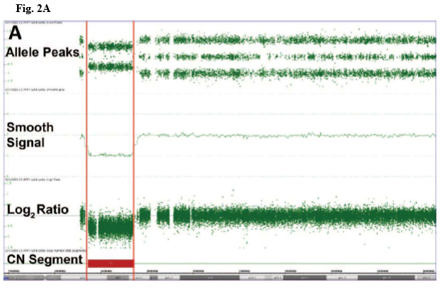 Figure 2A