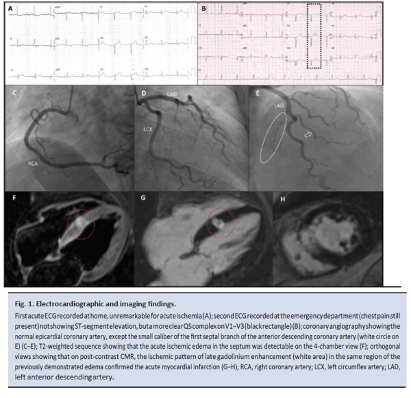 Figure 1 Electrocardiographic and imaging findings