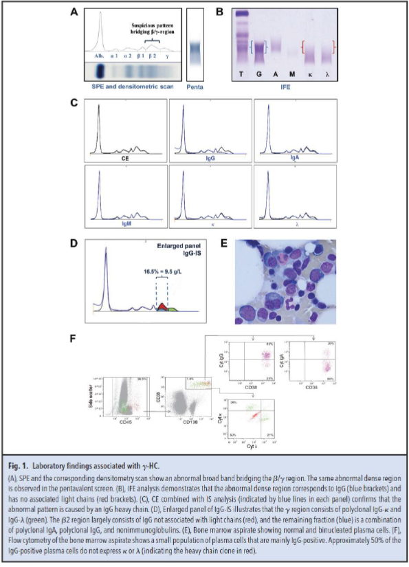 Figure 1. Laboratory findings associated with gamma-HC