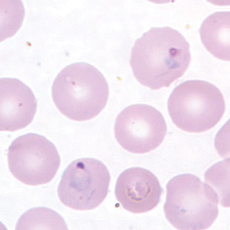 P. vivax in a thin blood smear.