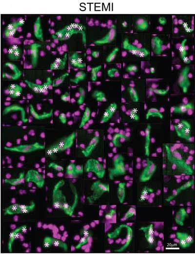Healthy circulating endothelial cells