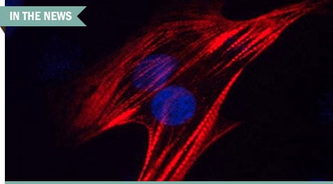 troponinincardiacdisease
