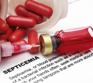 Septicemia