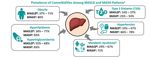 Prevalence of comorbidities