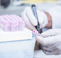 USB blood sample