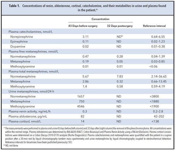 Table 1. Concentrations of renin, aldosterone, cortisol, catecholamine, and their metabolities in urine and plasma found in the patient
