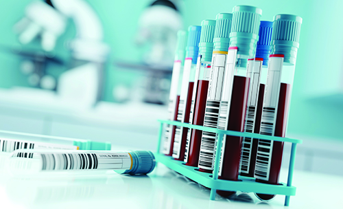 A collection of sample tubes with light blue lids filled with blood