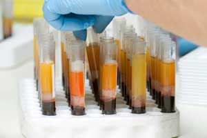 Vials of blood